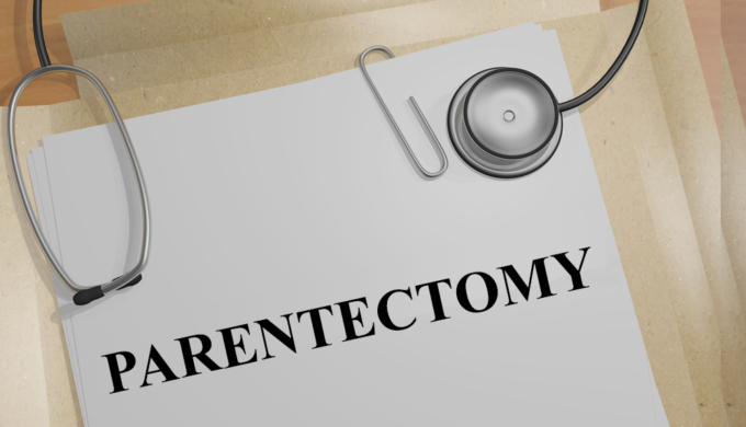 Parentectomy – Cutting Your Kid Loose (Part 2)